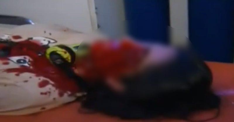 რუსთაველზე ახალგაზრდა ქალს თვალი დაუზიანდა - მას ოპერაცია უტარდება